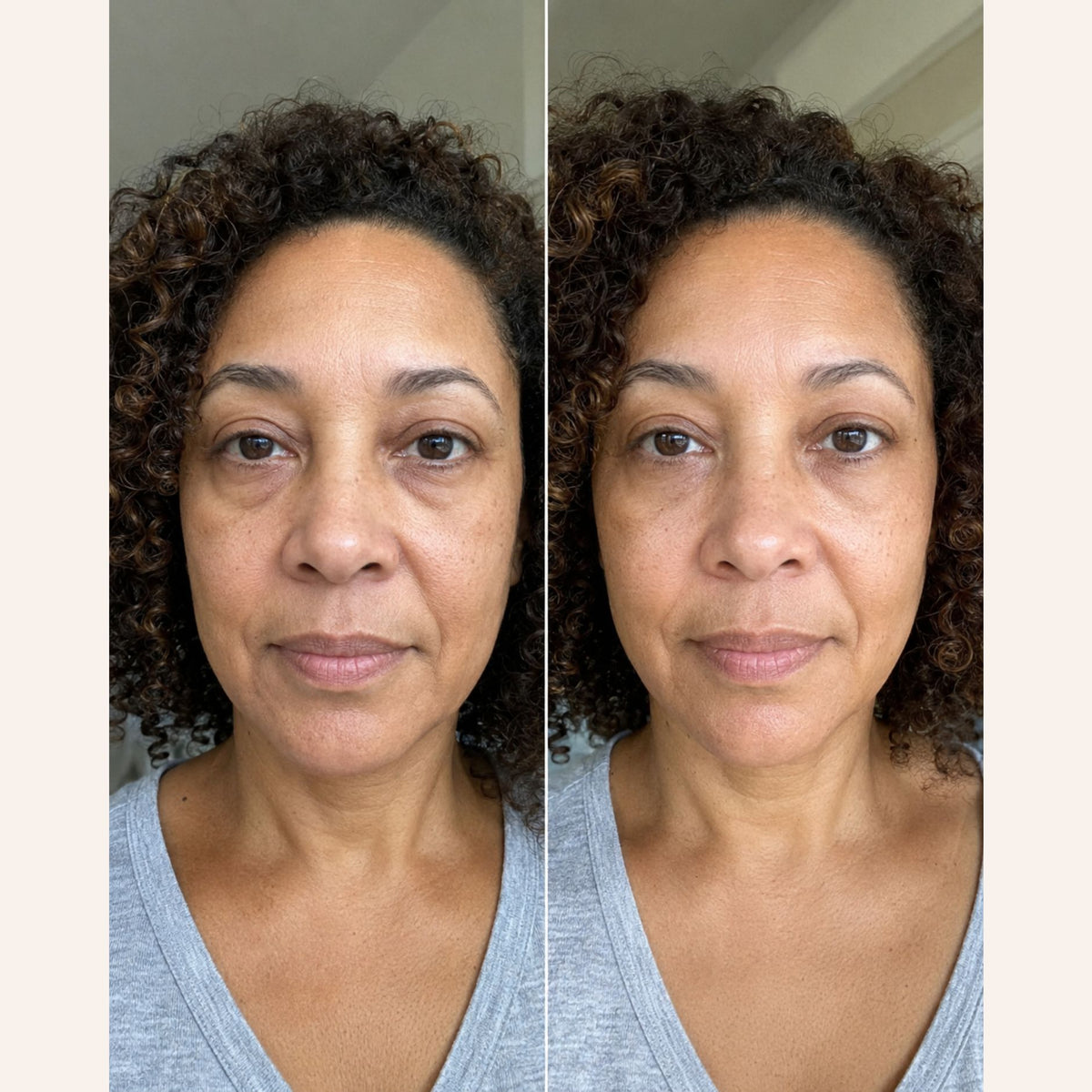 RevitalEyes® 2 en 1: terapia de luz roja + EMS para eliminar las bolsas de los ojos