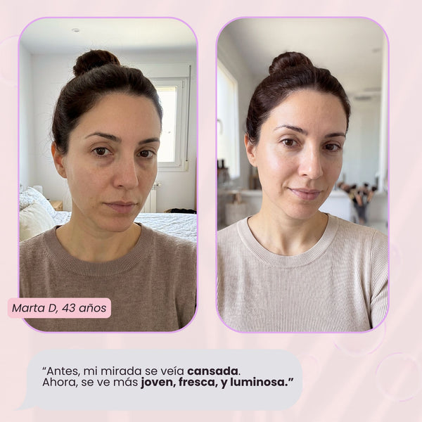 RevitalEyes® 2 en 1: terapia de luz roja + EMS para eliminar las bolsas de los ojos